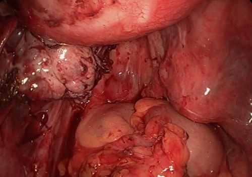 Klinischer Schritt 10