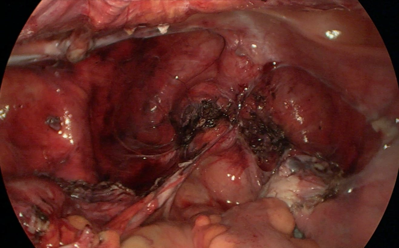Parametraner Knoten 3