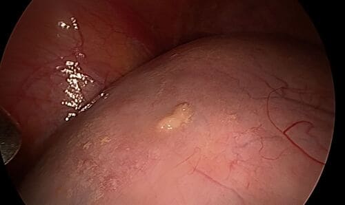 Klinischer Fall Schritt 1